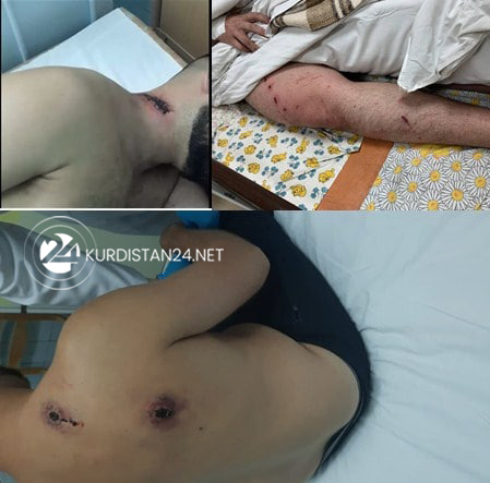 Victims of violence at the Belarus's border with Poland and Lithuania. (Photo: K24)